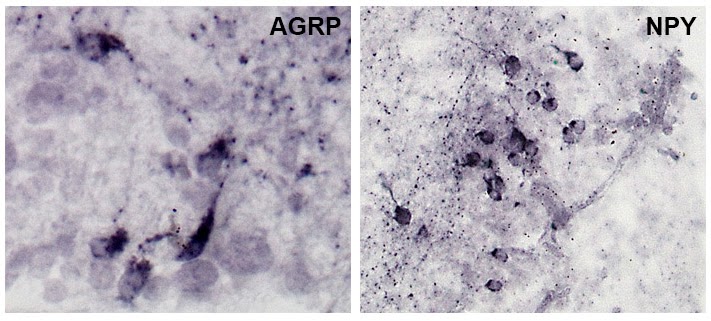 immunohistochemistry stains for feeding-related peptides in burtoni fish brains