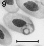 Plasmodium koreafense