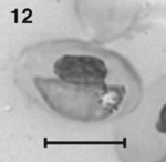 Plasmodium megalotrypa