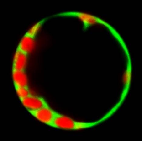 A single protoplast colored in green and red, visualized in a microscope using the fluorescent protein GFP