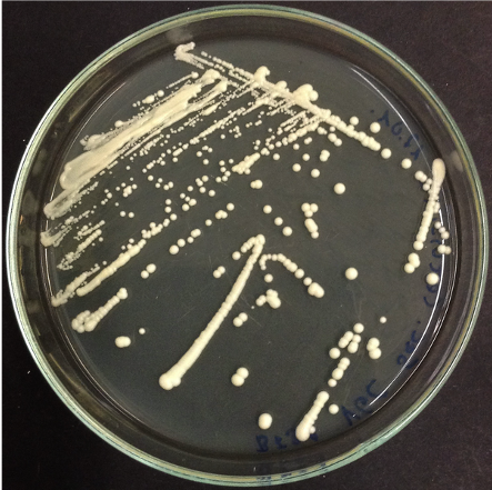 A plate with colonies of the yeast Saccharamyces cerevisiae growing on it
