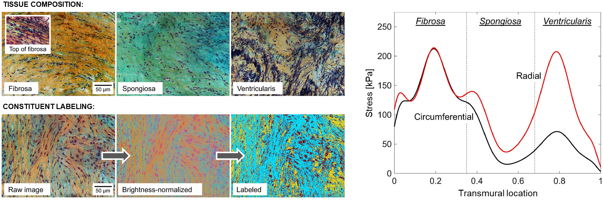 Aortic valve composition and stress