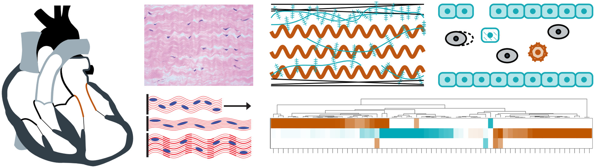 Mitral valve remodeling