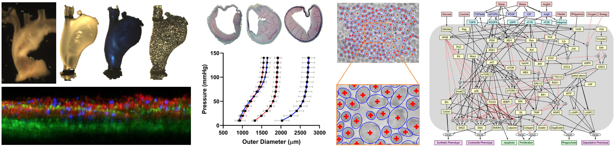 Multiscale models of vascular disease