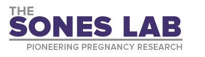 Sones Lab Logo