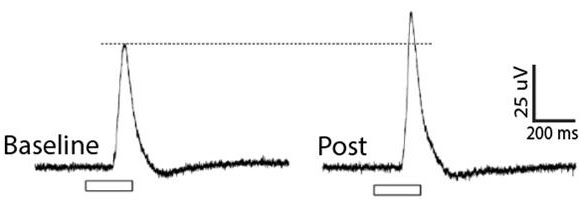 electroretinogram recordings of female burtoni before and afer ovulation