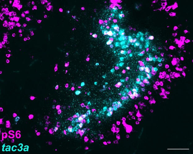 pS6 and tac3a stain in the brain