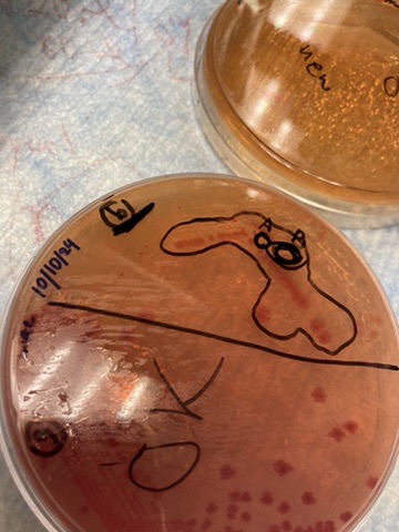 Bacterial culture on agar plate
