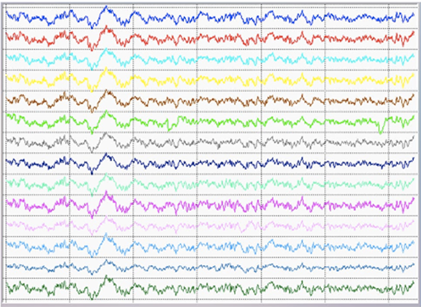 eeg signal