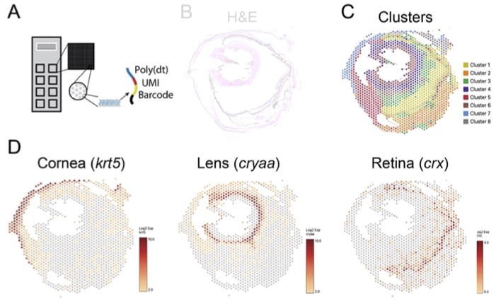 Spatial transcriptomics