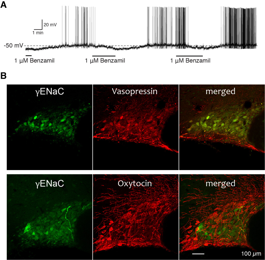 Expression of ENaC in Vasopressin neurons