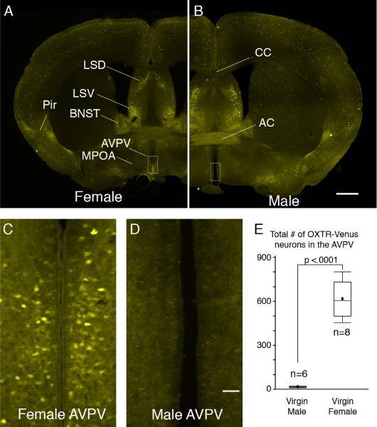 Sexually dimorphic expression of OXTR