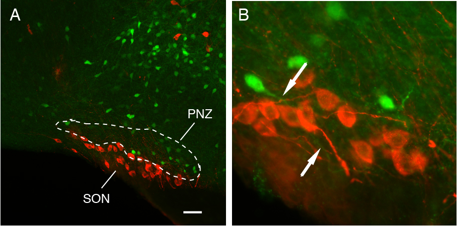 OXTR neurons in the perinuclear zone
