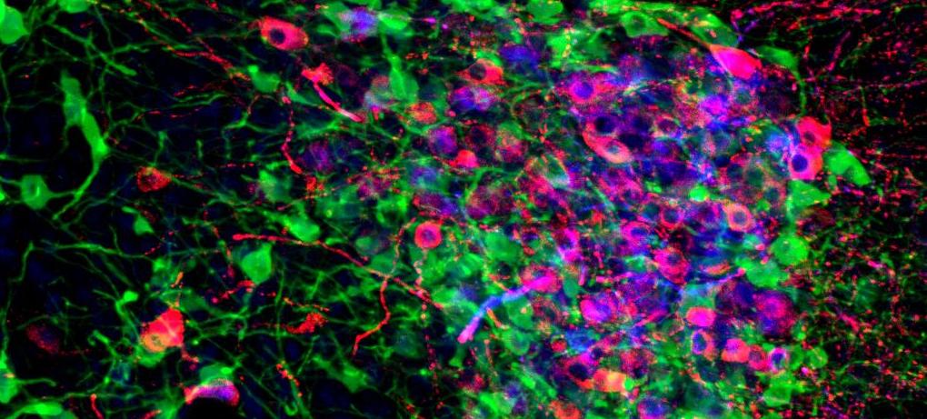 Fluorescence Photomicrograph of Oxytocin, Vasopressin, and TRPM4 in the PVN