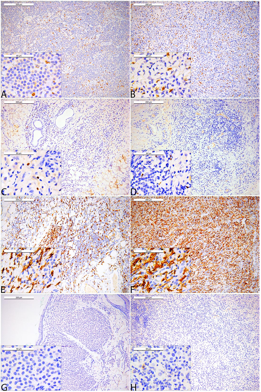 Immune cell infiltration of canine mast cell tumors